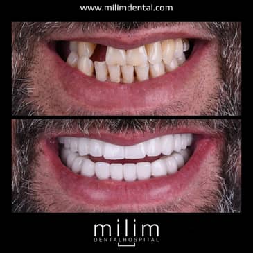 Slider image (9) Milim Dental
